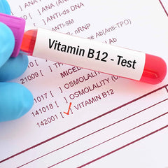 B-12 (Serum) Test