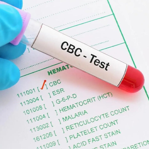 Complete Blood Count (Cbc) Test
