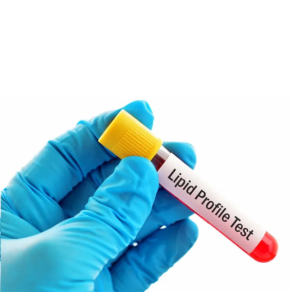 Lipid Profile Test