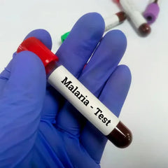 Mp (Malarial Parasite) Test
