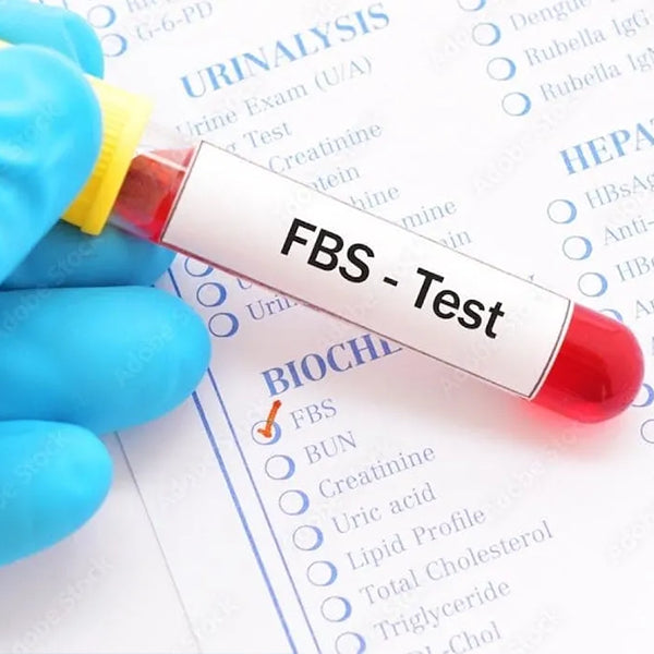 Fbs (Fasting Blood Sugar ) Test