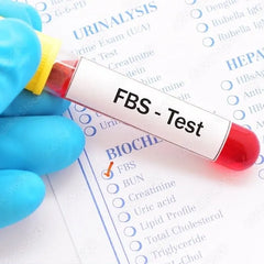 Fbs (Fasting Blood Sugar ) Test