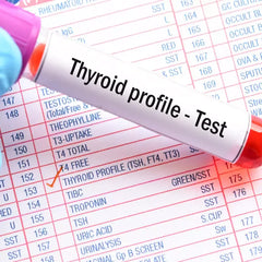 Thyroid Profile (T3, T4, Tsh) Test