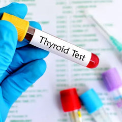 Thyroid-Stimulating Hormone (Tsh): Tsh Levels Test
