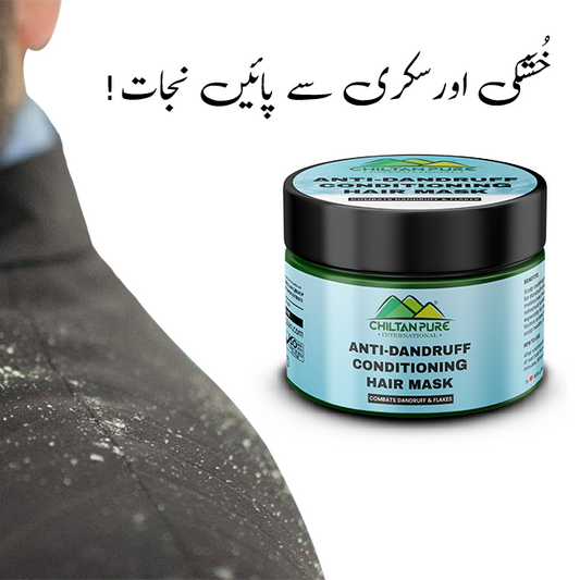 Anti Dandruff Conditioning Hair Mask – Formulated For Dandruff-Prone Scalp, Makes Hair Shiny & Soft