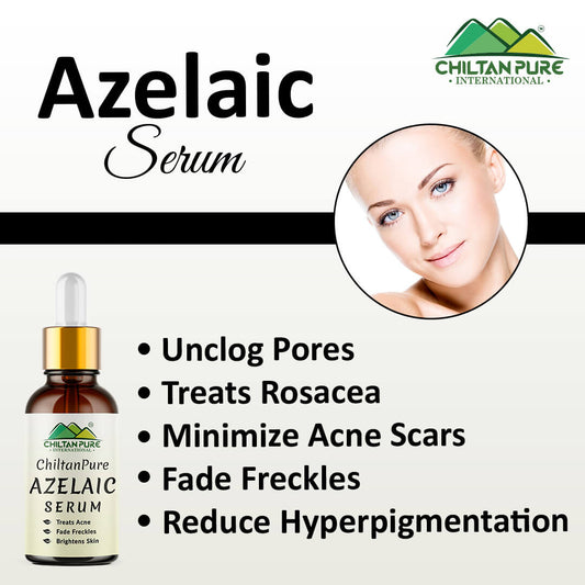 Azelaic Serum - Brightens Skin, Treats Acne, Unclogs Pores, Fade Freckles & Lighten Acne Scars!! - Mamasjan