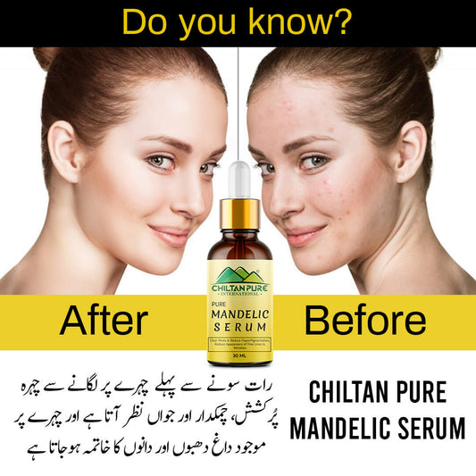 Mandelic Serum - Get Brighter & Luminous Complexion - Mamasjan