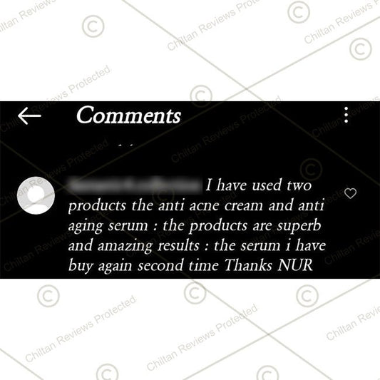 Nur Anti Acne Cream – Say bye to Acne, reduces hyperpigmentation, minimize age spots – 100% pure - Mamasjan