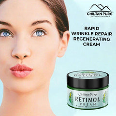 Retinol Cream – Hydrates Skin, Treats Severe Acne, Stimulates Collagen Production & Reduce Fine lines - Mamasjan