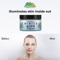 Winter Glow Cream – Formulated With Multivitamins & Moisturizers, Makes Skin Soft & Supple, Good For Dry & Dehydrated Skin - Mamasjan