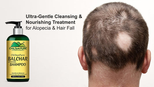 Balchar (jatamansi) shampoo - Ultra-gentle cleansing and nourishing treatment for alopecia & hair fall - Mamasjan