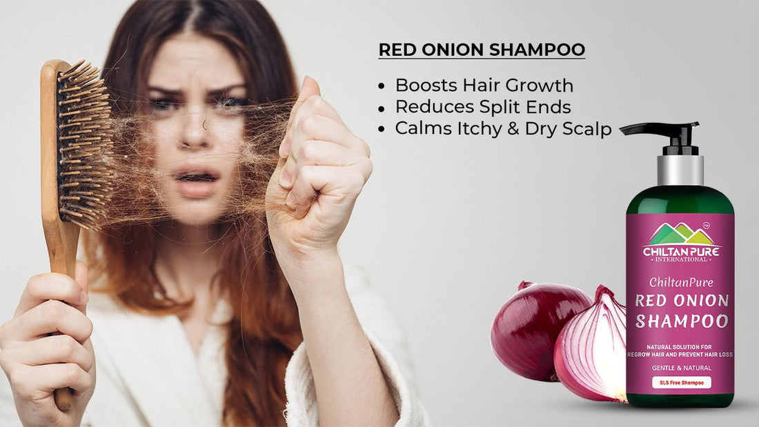 Red Onion Shampoo Boost Hair Growth - Reduce Split Ends, Calms Itchy & Dry Scalp - Mamasjan