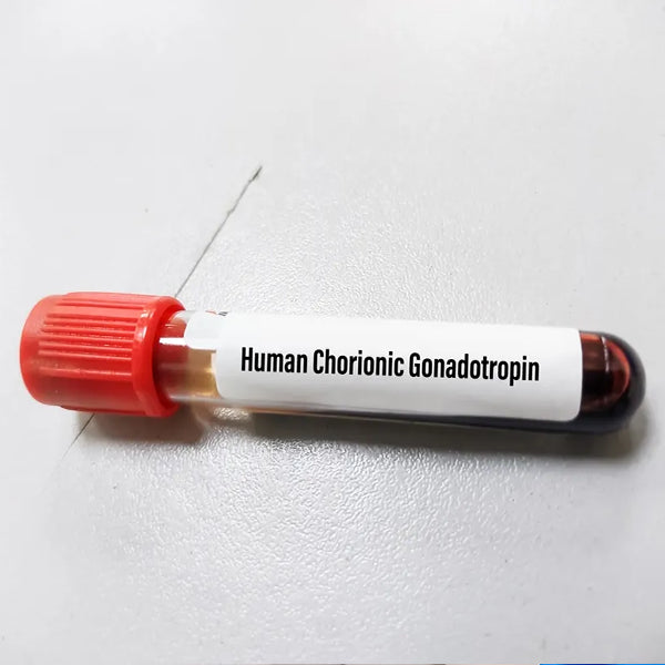 Beta Human Chorionic Gonadotropin (Beta-Hcg) Test