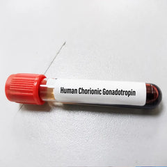Beta Human Chorionic Gonadotropin (Beta-Hcg) Test