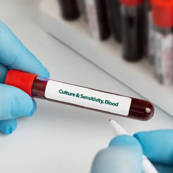 Culture & Sensivity (Blood) Test