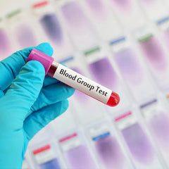 Blood Group Test