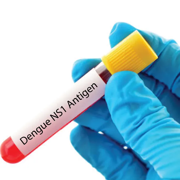Dengue Ns1 Antigen Test