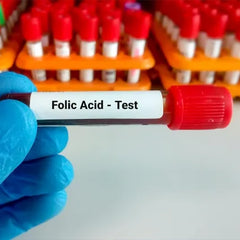 Folate (Folic Acid) Serum Test