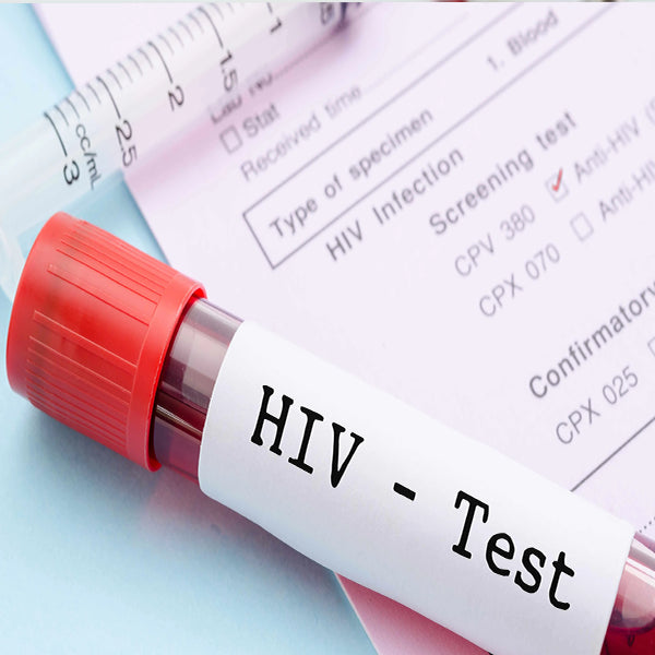 Hiv Test