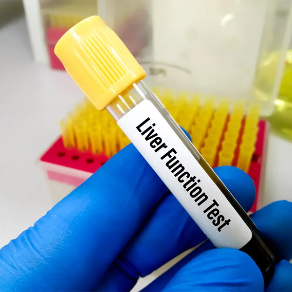 Liver Functions Test - Lft Test