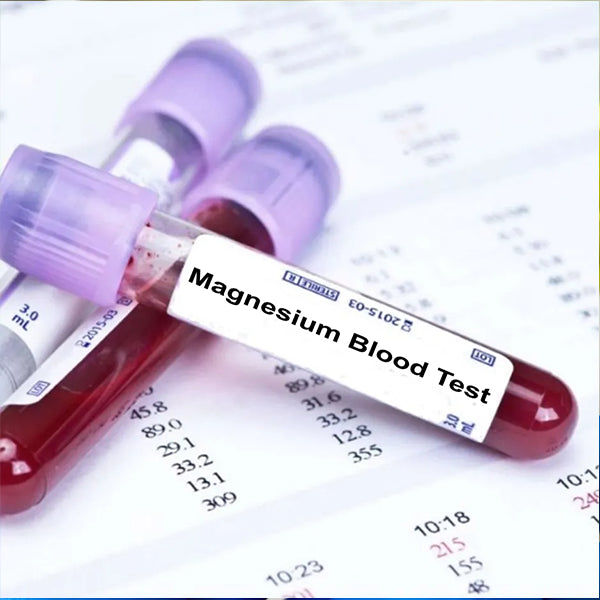 Magnesium Test