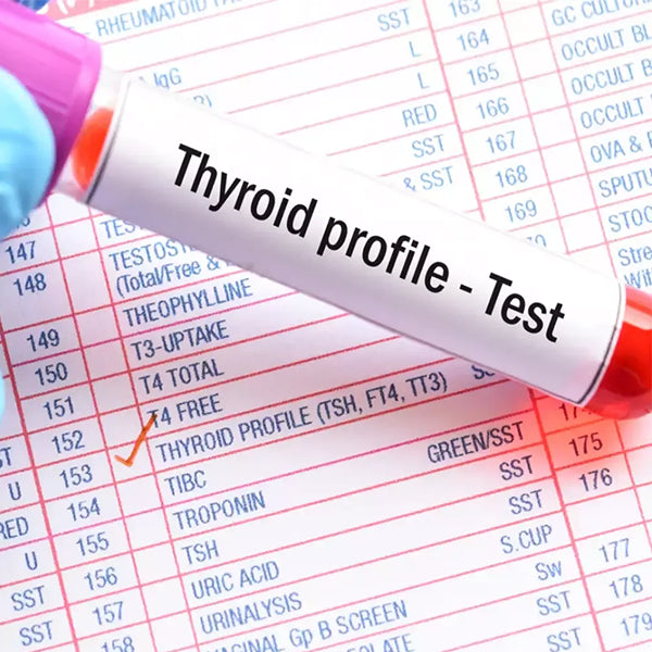 Thyroid Profile (T3, T4, Tsh) Test