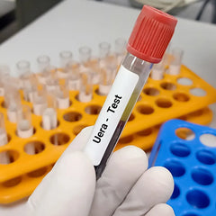Urea Test