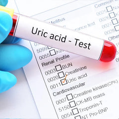 Uric Acid Test