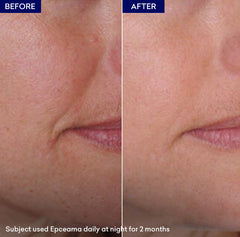 Epceama Anti Aging Serum