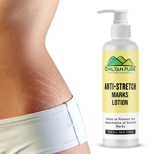 Anti-Stretch Marks Lotion – Formulated To Repair, Diminish & Prevent Stretch Marks With Intense Hydration & Smoothing, Good For Pregnancy Skincare