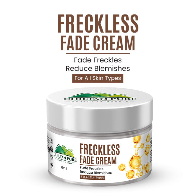 Freckles Fade Cream – Hydrates Skin, Fade Freckles, Reduce Blemishes & Lightens Hyperpigmentation