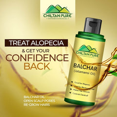 Balchar (Jatamansi) Oil – Effective for Alopecia, Enlarges Follicular Hair Size & Prevents Scalp Infections