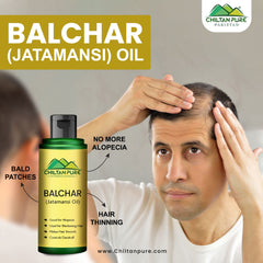 Balchar (Jatamansi) Oil – Effective for Alopecia, Enlarges Follicular Hair Size & Prevents Scalp Infections