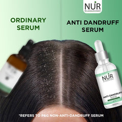 Anti-Dandruff Serum – Smoothing Hydrating Formula with Heat Protection for Dry, Frizzy & Damaged Hair