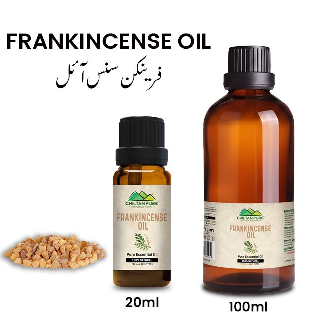 Frankincense Essential Oil – Best for Removing Dark Circles
