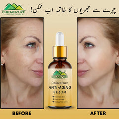 Anti-Aging Serum – Hydrate Skin, Anti – Wrinkle, Reduce Fine Lines & Fights Signs of Ageing