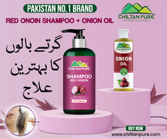 Red Onion Shampoo 🧅 Natural Solution for Regrow Hair & Prevent Hair Loss 100% Results