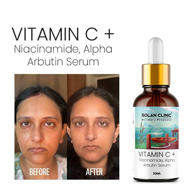 Vitamin C + Face Serum - Mamasjan