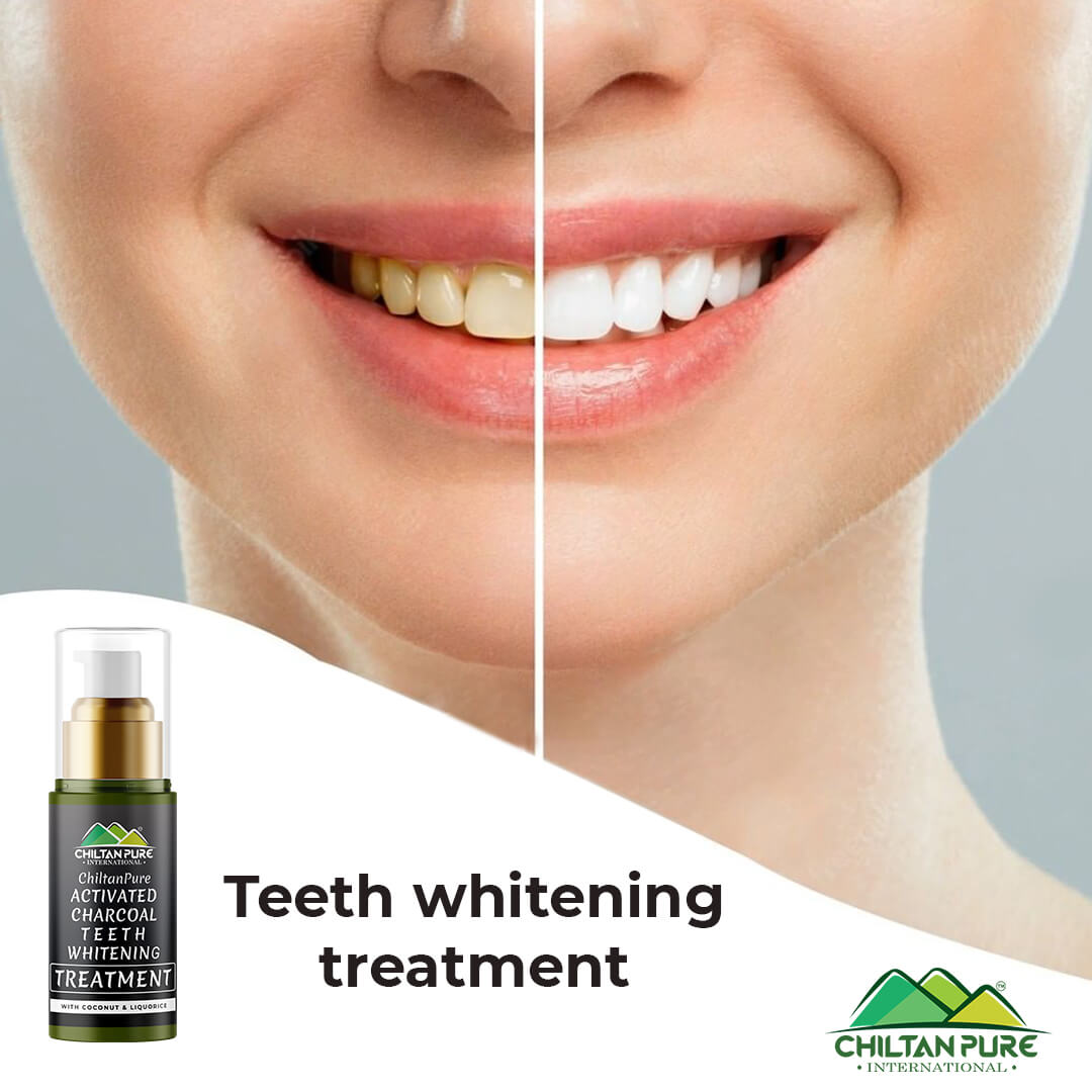 Activated Charcoal Teeth Whitening Treatment - Whitens Teeth Naturally, Kills Cavity causing Bacteria &amp; Eliminates Bad Breath - Mamasjan
