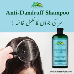 Anti Dandruff Shampoo – Strengthens Hair, Eliminate Wet Dandruff, Soothes Scalp Itching & Contains Anti-Dandruff Properties - Mamasjan