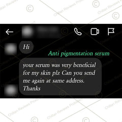 Anti-Pigmentation Serum – Brighten Skin, Lighten Pigmentation, Fade Freckles & Even Skin Tone - Mamasjan