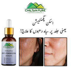 Anti-Pigmentation Serum – Brighten Skin, Lighten Pigmentation, Fade Freckles & Even Skin Tone - Mamasjan
