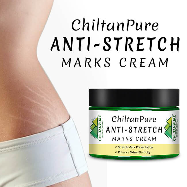Anti-Stretch Marks Cream – Formulated With Shea Butter, Coco Butter & Vitamin E, Prevent Scars & Stretch Marks With Intense Hydration & Smoothing 30ml - Mamasjan