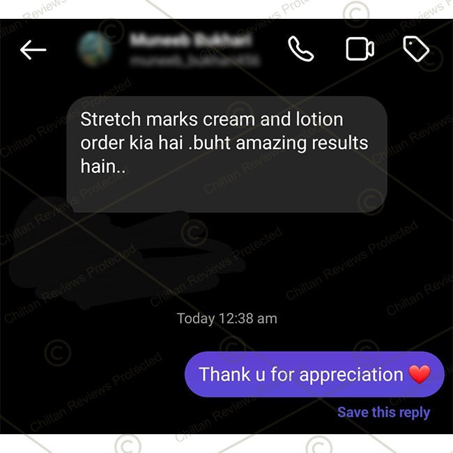 Anti-Stretch Marks Cream – Formulated With Shea Butter, Coco Butter & Vitamin E, Prevent Scars & Stretch Marks With Intense Hydration & Smoothing 30ml - Mamasjan