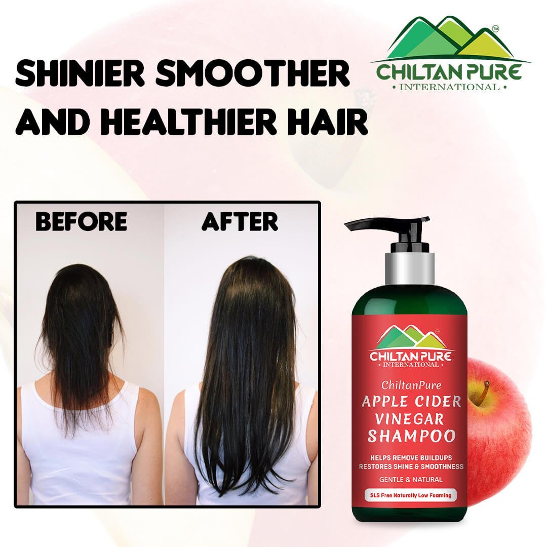 Buy MAXBELLA® Apple Cider Vinegar Hair Oil for Hair Growth and Hair Fall  Control | No Silicon and Mineral Oil | Hair Oil for Men and Women | Non  Sticky Hair Oil |