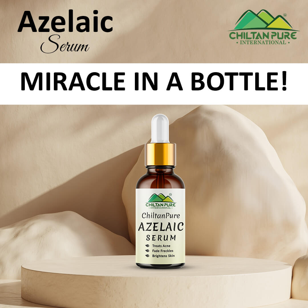 Azelaic Serum - Brightens Skin, Treats Acne, Unclogs Pores, Fade Freckles & Lighten Acne Scars!! - Mamasjan