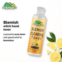 Blemish Clearing Toner – Soothes Redness & Inflammation, Fights with Acne & Helps Prevent Breakouts, Good For All Skin Types - Mamasjan