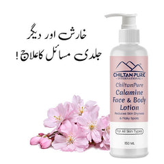 Calamine Lotion – Solution to every allergy, contains anti-allergic properties, Reduces skin dryness – 100% organic - Mamasjan