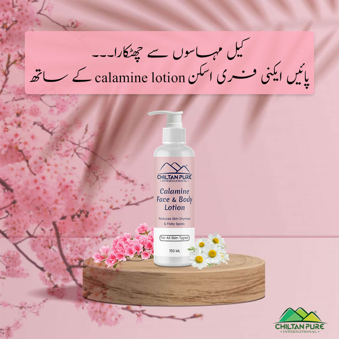 Calamine Lotion – Solution to every allergy, contains anti-allergic properties, Reduces skin dryness – 100% organic - Mamasjan