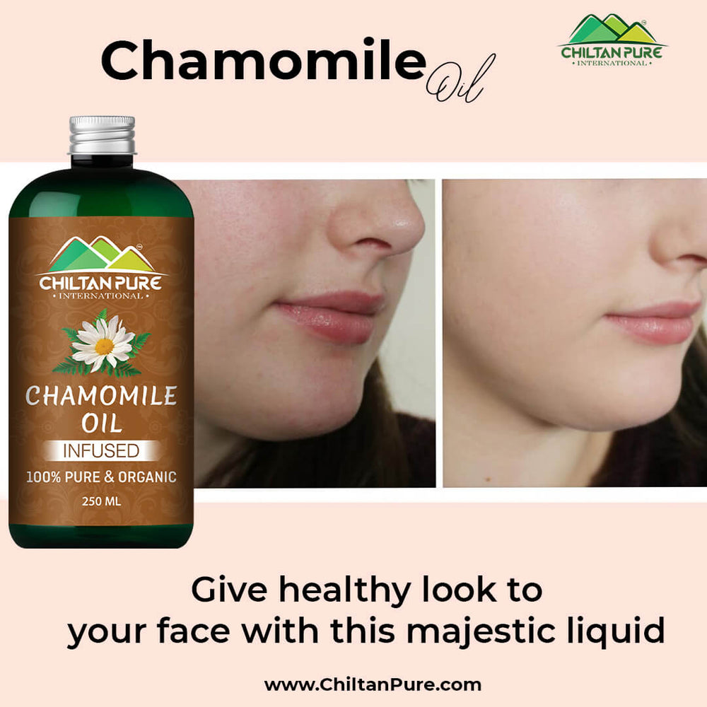 Chamomile Oil – Give Healthy Look to Your Face & Hair With This Majestic Liquid [بابونہ] - Mamasjan